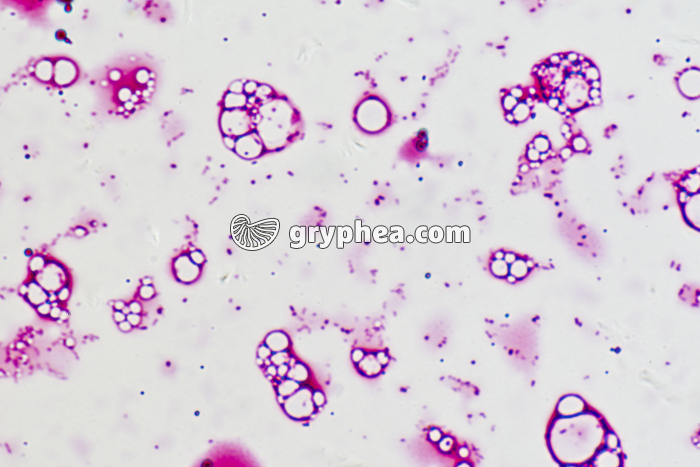 Salmonella typhi x320 - gryphea.com